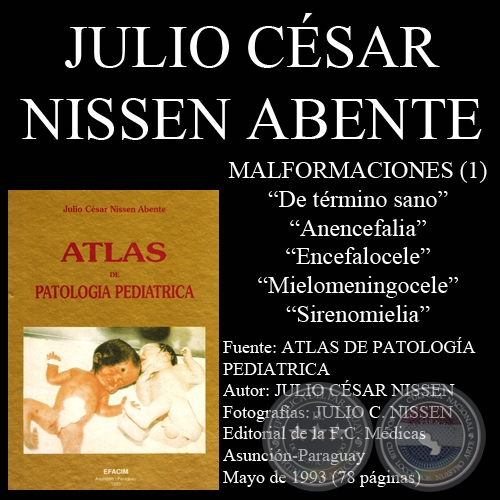 ENFERMEDADES CONGENITAS - MALFORMACIONES - JULIO CÉSAR NISSEN ABENTE